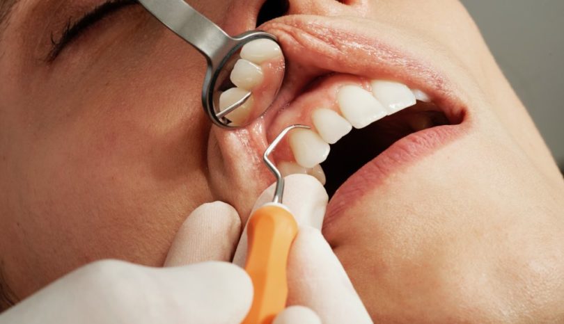 Tandläkare i Kista som erbjuder moderna lokaler, bra behandlingar samt stort fokus på den enskilda patienten